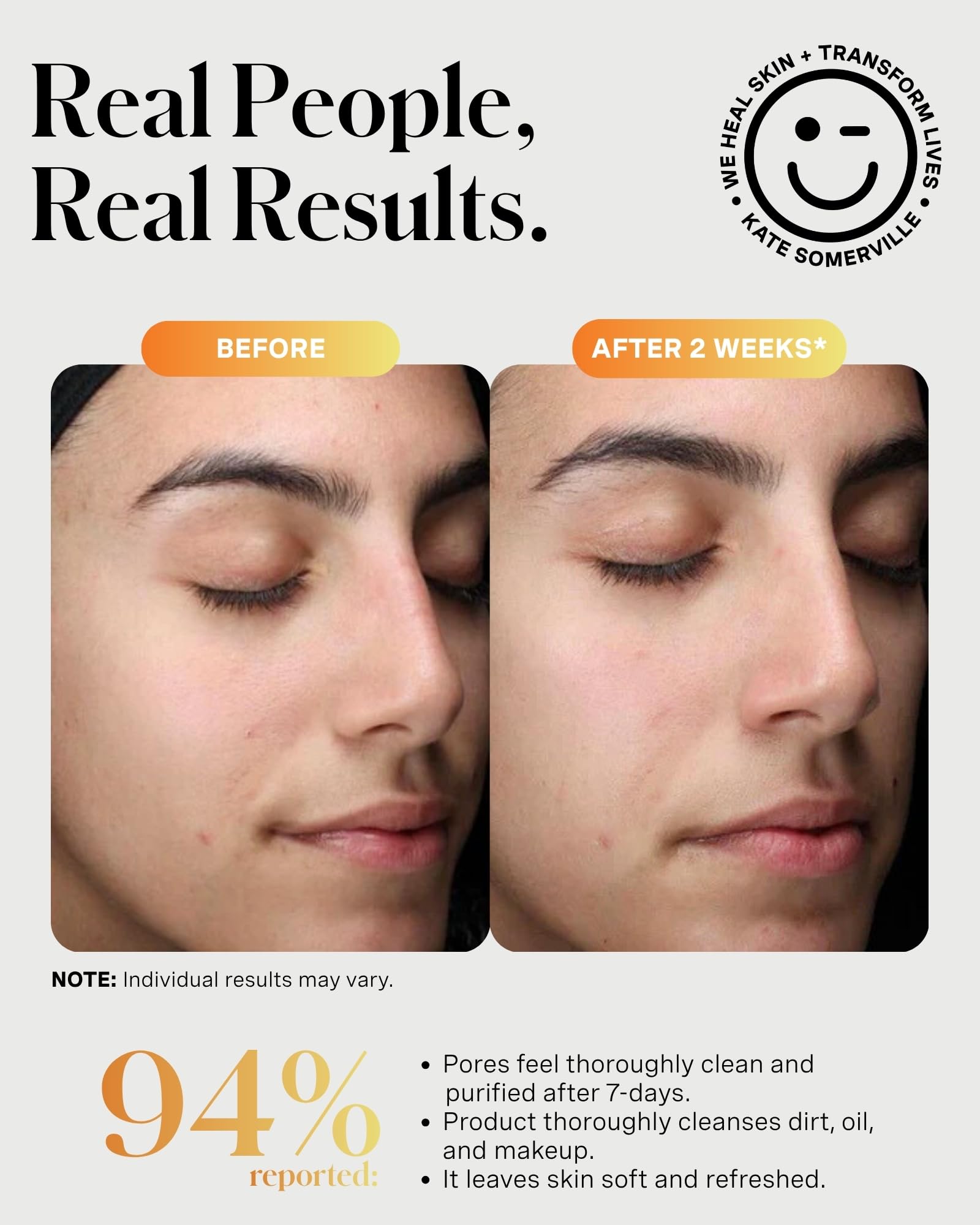 Kate Somerville ExfoliKate Cleanser – Daily Exfoliating Foaming Face Wash, Clinically Formulated Glycolic Acid and Lactic Acid Gentle