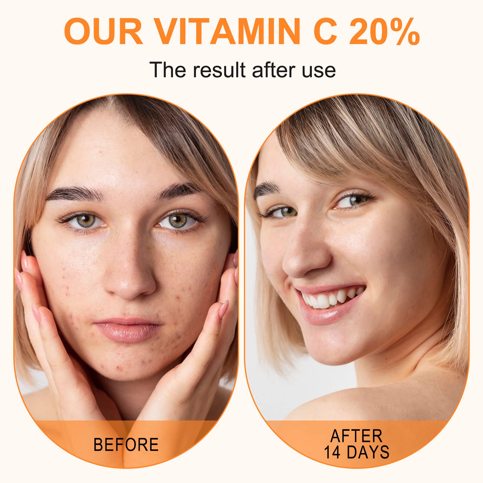 Premium 20% Vitamin C Serum For Face with Hyaluronic Acid, Retinol & Amino Acids - Boost Skin Collagen,Hydrate & Plump Skin,