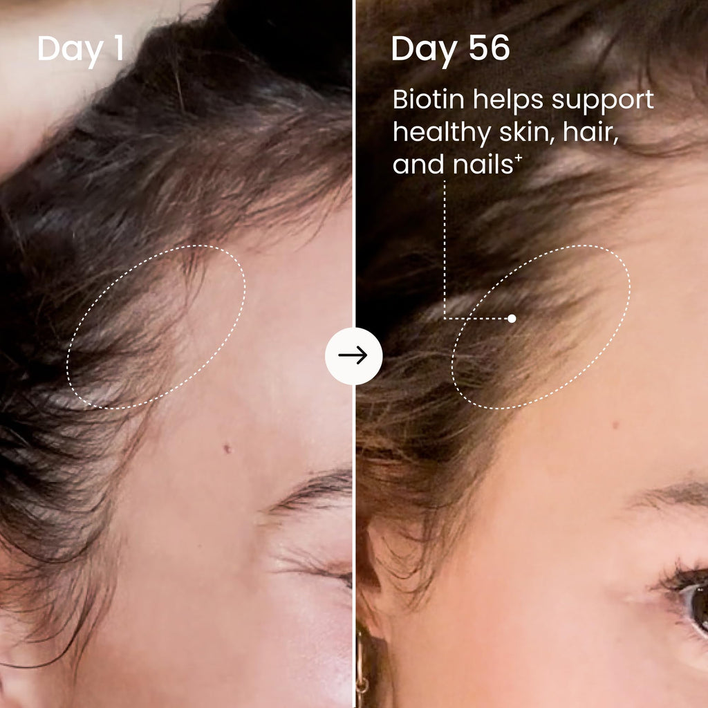 MAËLYS Collagen + BIOTIN Supercharged Liquid Collagen - Drinkable Hydrolyzed Type I & III Collagen Supplement with Biotin, Vitamin C, Zinc & Folic Acid