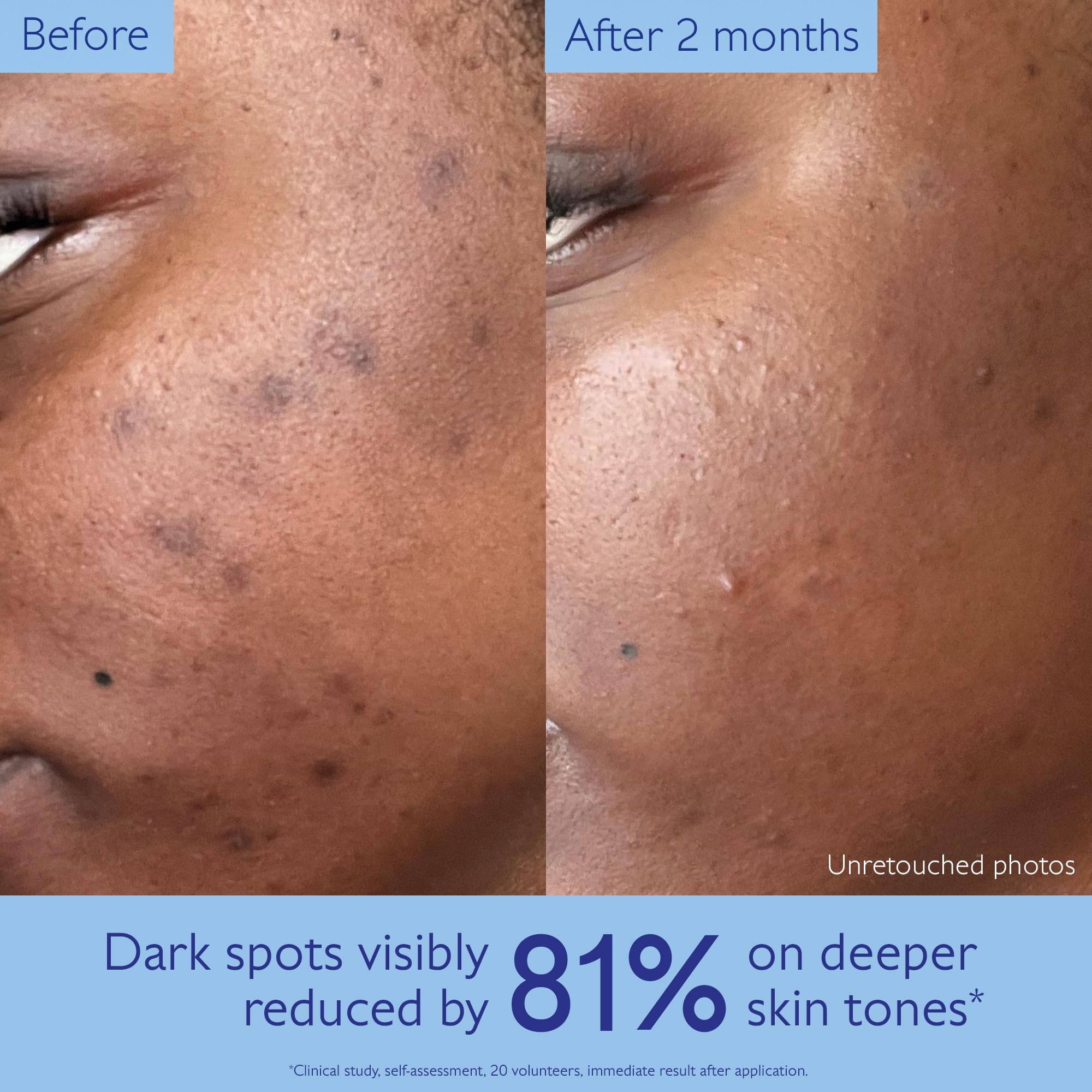 Caudalie Vinoperfect Brightening Dark Spot Serum Vitamin C Alternative - 62x More Effective than Vitamin C with Viniferine