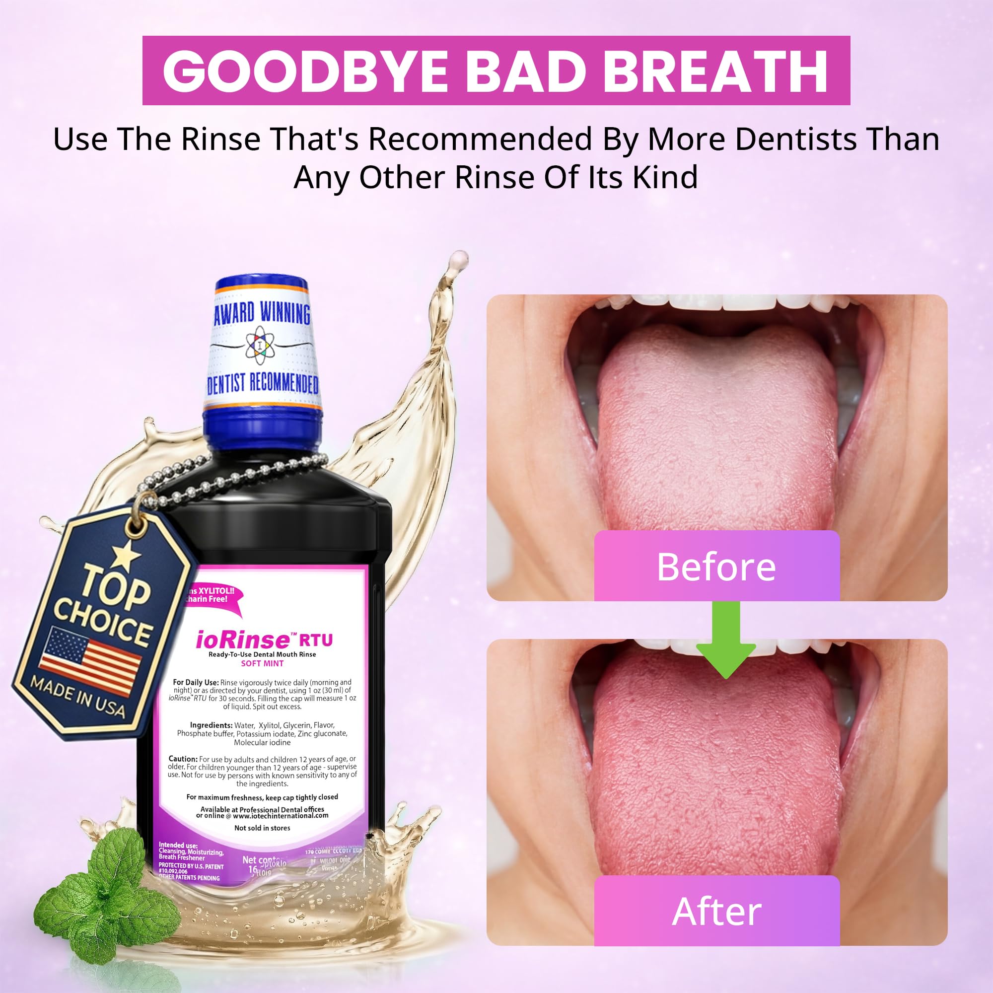 Recommended by 1,000s of Dental Professionals Because it Simply Works Better. Professional Strength ioRinse RTU. Powerful, Long-Lasting, Breath freshening that You Can Trust. Soft Mint 16.9 oz